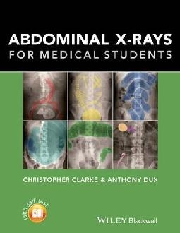 Abdominal X-rays for Medical Students