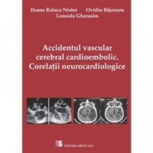 Accidentul vascular cerebral cardioembolic. Corelatii neurocardiologice