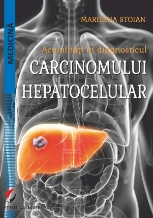 Actualităţi în diagnosticul carcinomului hepatocelular