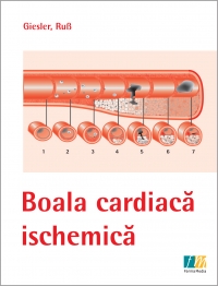 Boala cardiaca ischemica