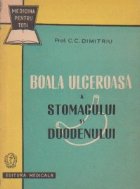 Boala ulceroasa stomacului duodenului