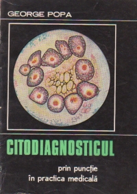 Citodiagnosticul prin punctie in practica medicala