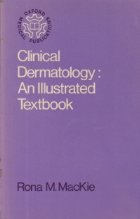 Clinical dermatology: An Illustrated Textbook