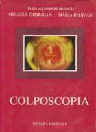 Colposcopia