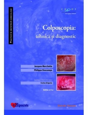 Colposcopia : tehnică şi diagnostic