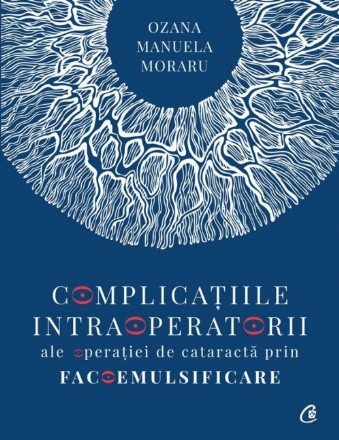 Complicatiile intraoperatorii ale operatiei de cataracta prin facoemulsificare