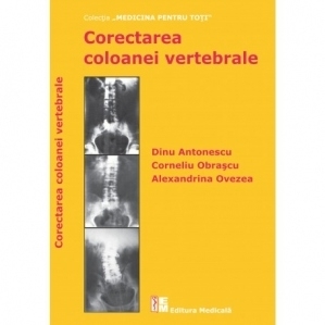 Corectarea coloanei vertebrale