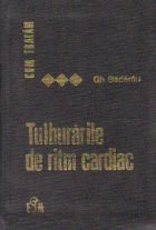 Cum tratam tulburarile de ritm cardiac