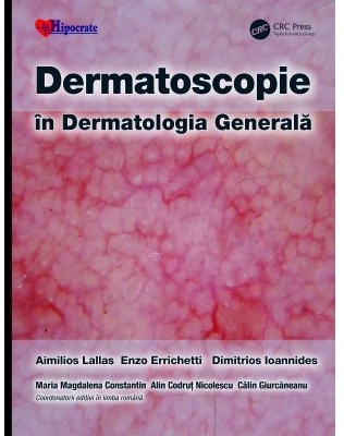 Dermatoscopie in Dermatologia Generala