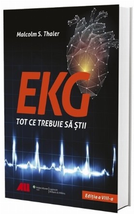 EKG - Tot ce trebuie să știi