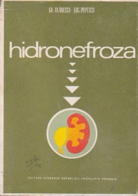 Hidronefroza