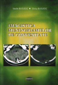 Imagistica meningioamelor de convexitate