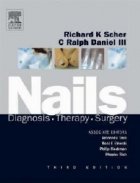 Nails Diagnosis Therapy Surgery