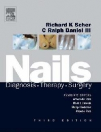 Nails : Diagnosis, Therapy, Surgery