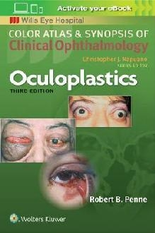 Oculoplastics