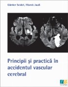 Principii practica accidentul vascular cerebral