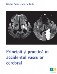 Principii si practica in accidentul vascular cerebral