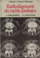 Radiodiagnostic rachis lombaire