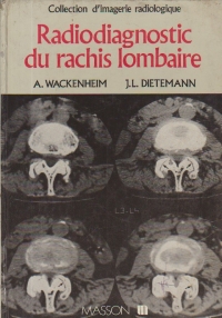 Radiodiagnostic du rachis lombaire