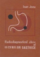 Radiodiagnosticul clinic ulcerelor gastrice