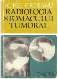 Radiologia stomacului tumoral