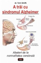 trai sindromul Alzheimer