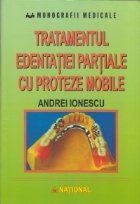 Tratamentul edentatiei partiale proteze mobile