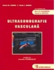 Ultrasonografie vasculara