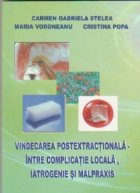 Vindecarea postextractionala – intre complicatie