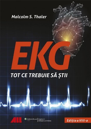 ekg-tot_ce_trebuie_sa_stii-c1.jpg